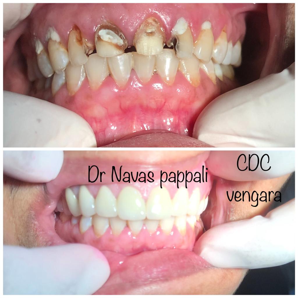 CAREWELL DENTAL CLINIC VENGARA