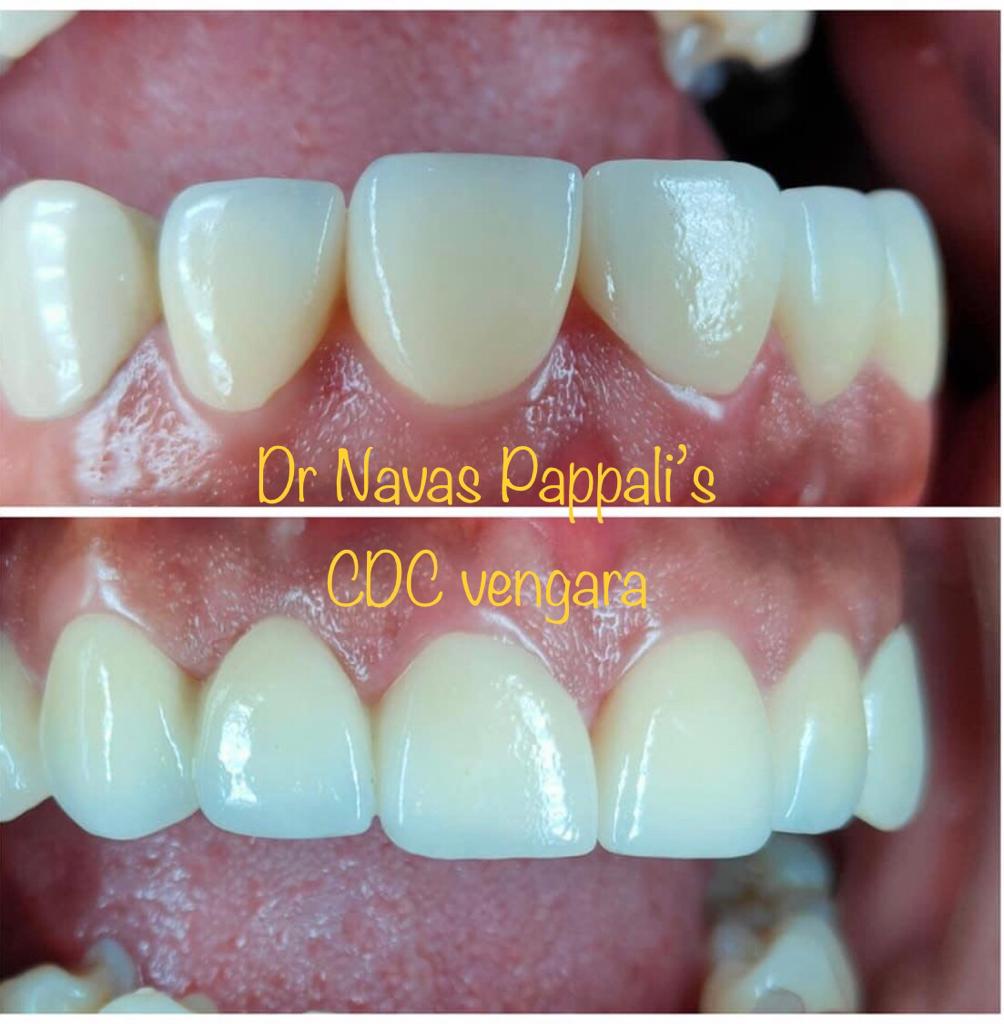 CAREWELL DENTAL CLINIC VENGARA