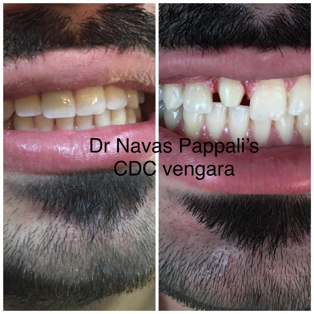 CAREWELL DENTAL CLINIC VENGARA