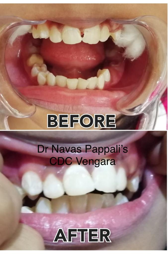 CAREWELL DENTAL CLINIC VENGARA